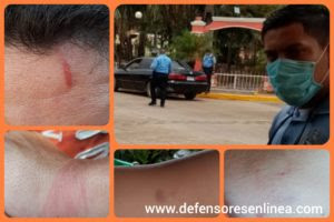 Imágenes que muestran las agresiones contra Heydi y Roberto Amaya, por la policía en Campamento, Olancho.