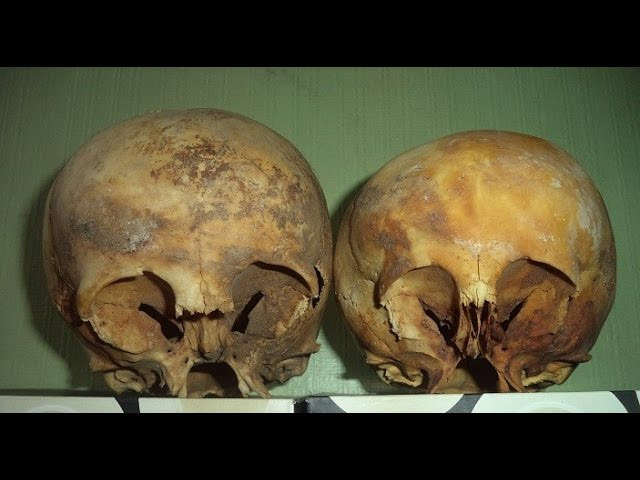 The Star Children Skulls Of Peru  Sddefault