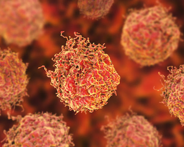 Phase III combination trial improves survival in men with metastatic prostate cancer