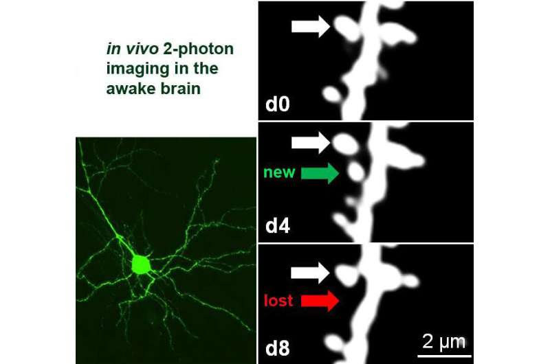 Watching the brain learn