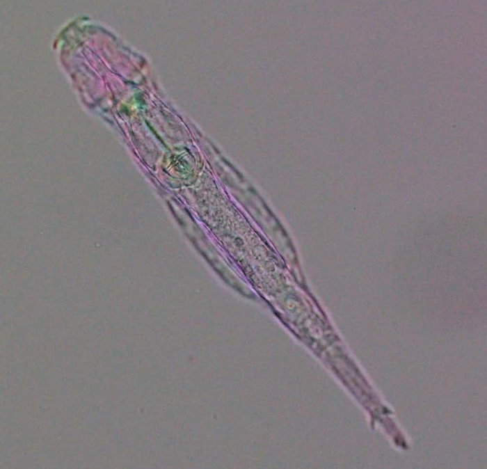 Bdelloid rotifer