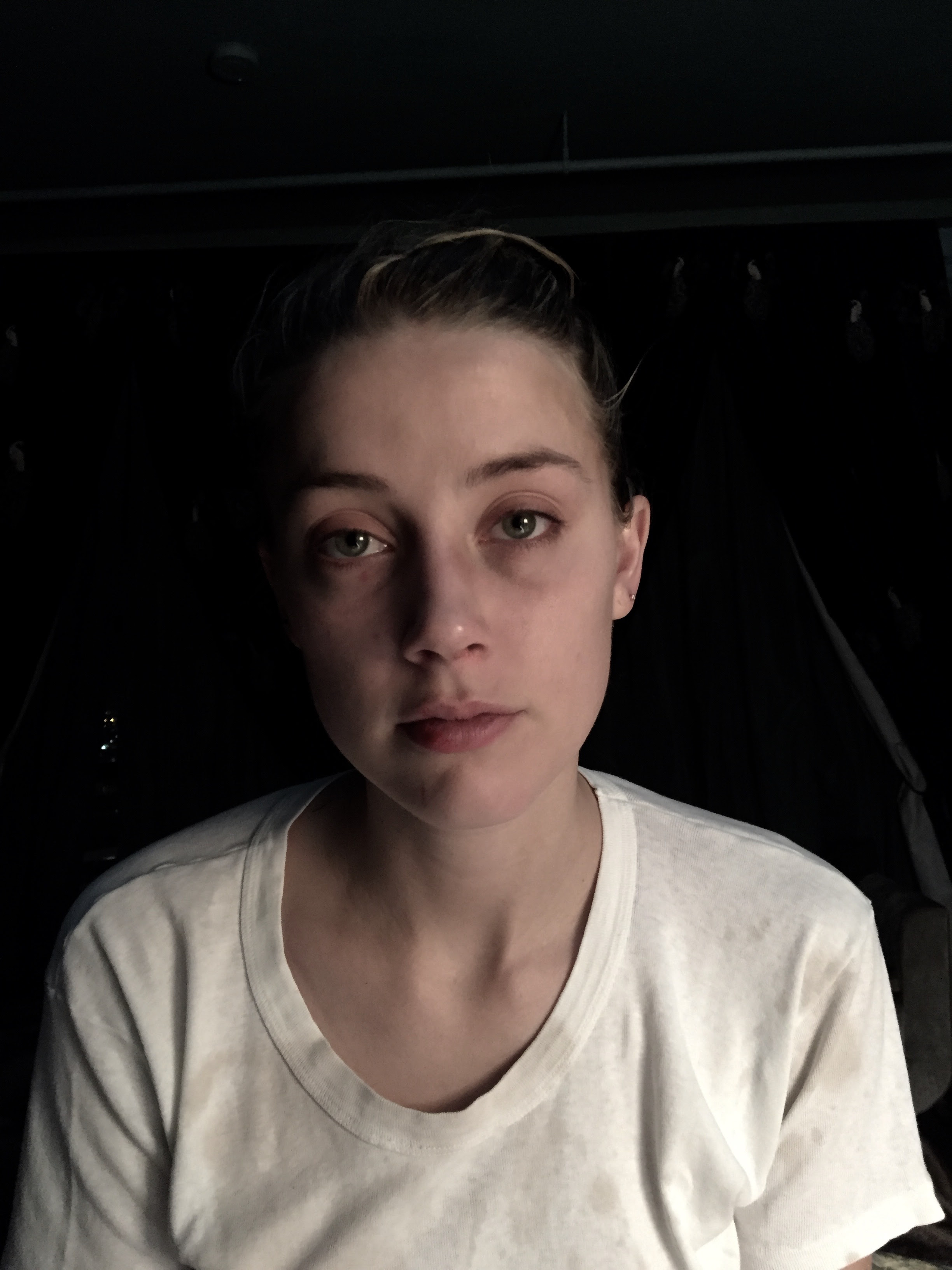 Pictures of Amber Heard's black eyes were shown in court
