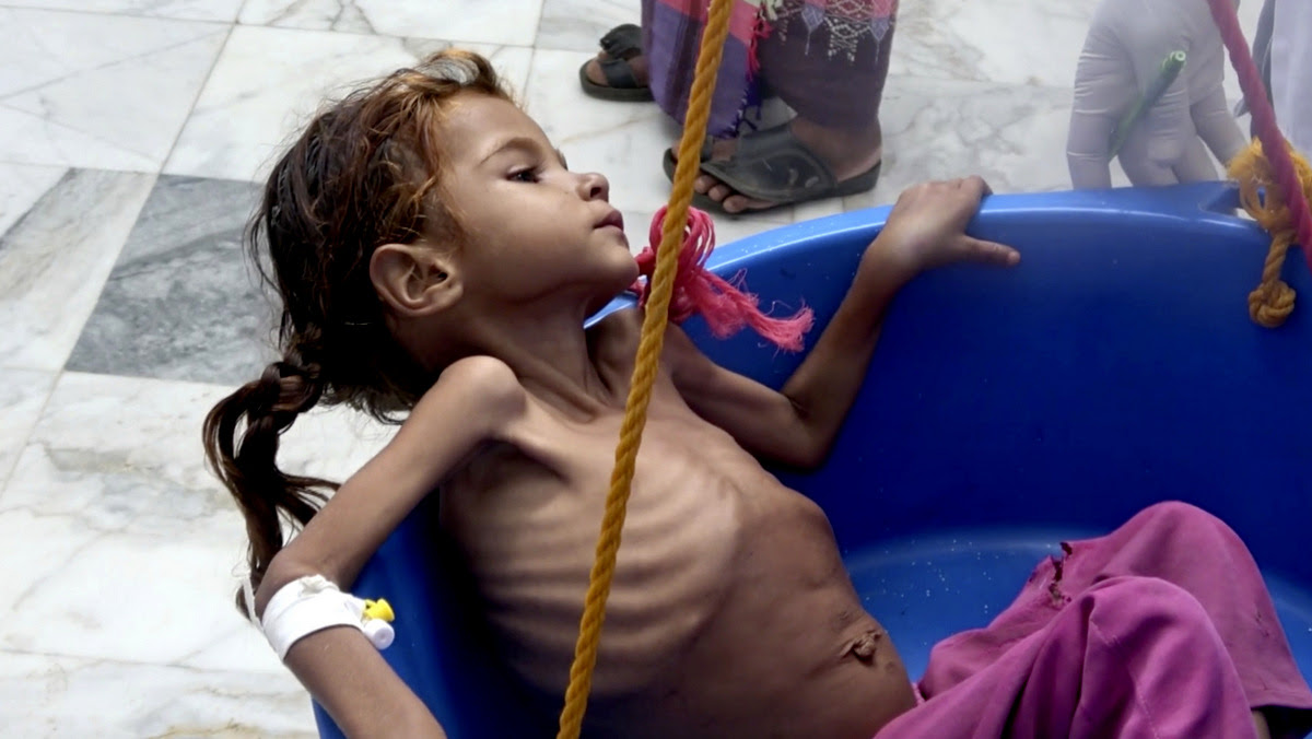 Yemen Saudi Zio Wahhabi Worlds Worst Humanitarian Crisis Shoah