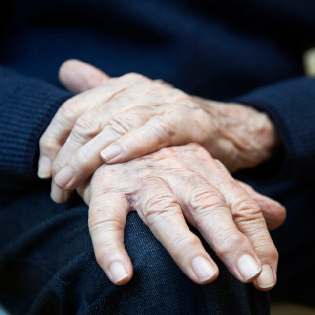 Parkinson's disease hands