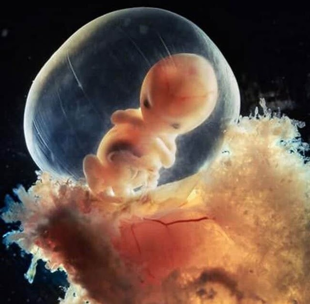 Những bức ảnh đáng kinh ngạc về sự phát triển của thai nhi trong bụng mẹ - 11
