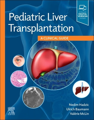 Pediatric Liver Transplantation: A Clinical Guide in Kindle/PDF/EPUB