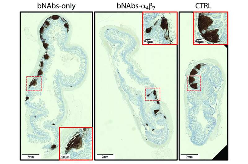 A page from the Covid therapy playbook: Unleashing a flood of neutralizing antibodies against HIV