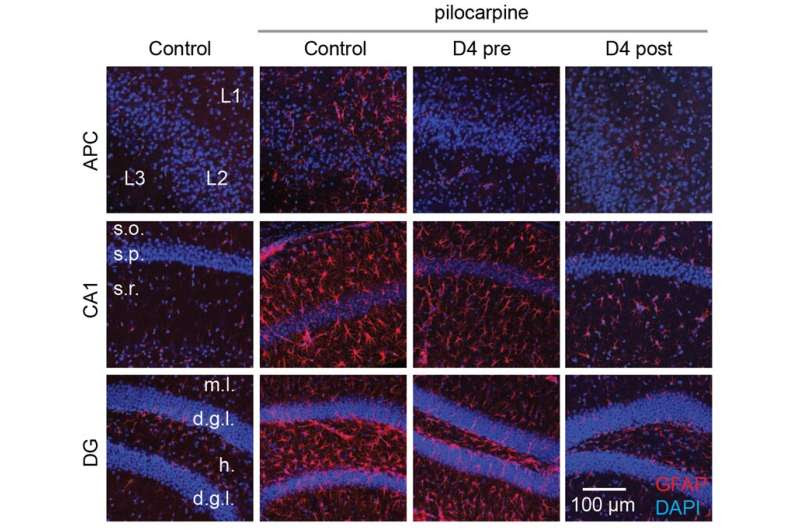 CityU neuroscientists discover a new drug candidate for treating epilepsy