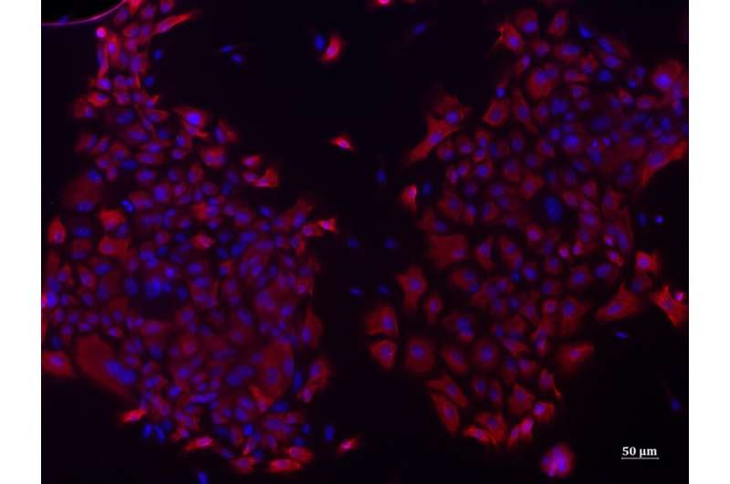 Chronic obstructive pulmonary disease: A genetic mutation confirmed as predisposing factor