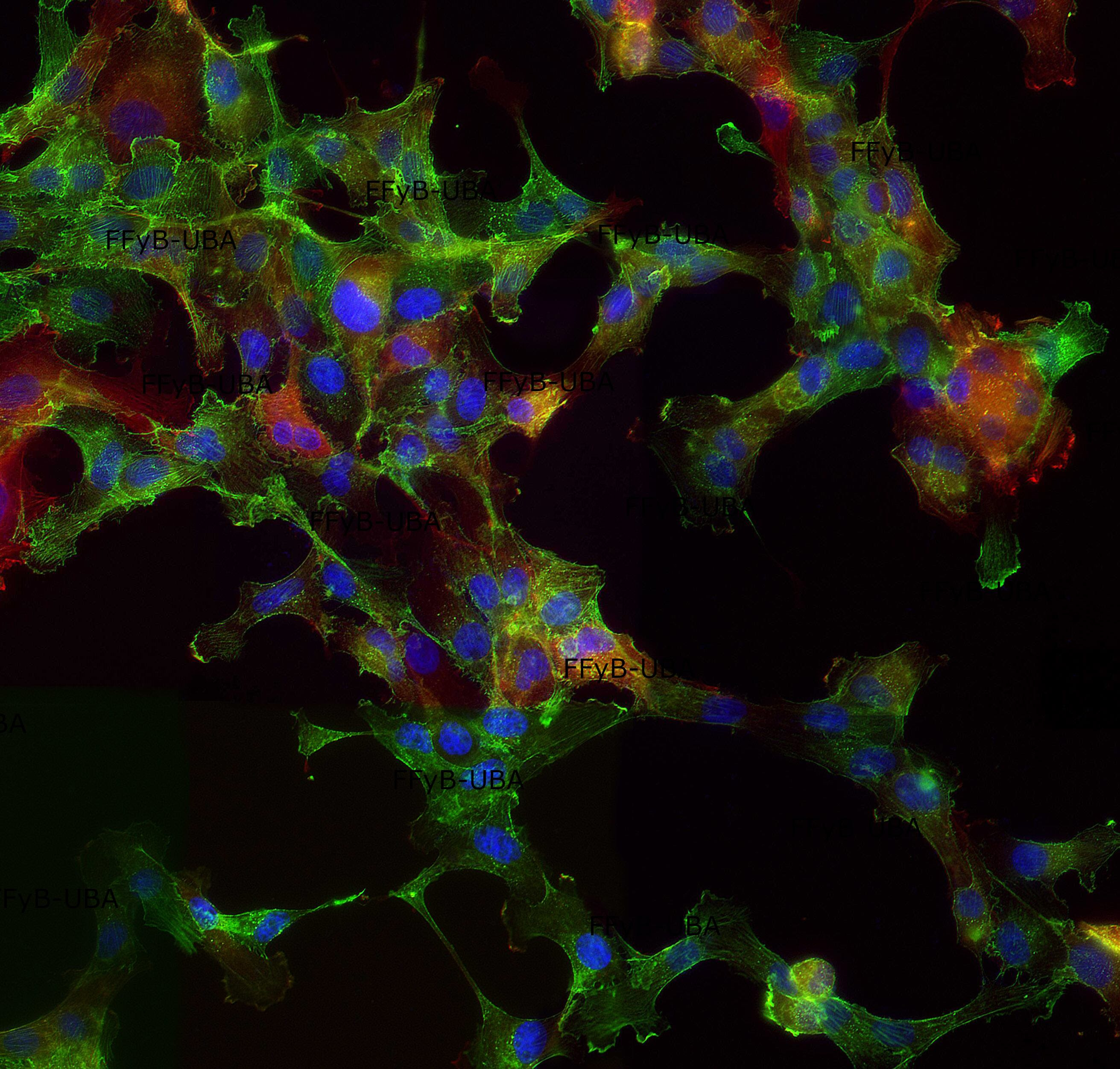 El catálogo es una herramienta de estudio que funcionará como una suerte de microscopio virtual. Imágenes de Biología celular y molecular. Tráquea completa: Tinción Hematoxilina-Eosina-Alcian Blue. Microscopía de campo claro