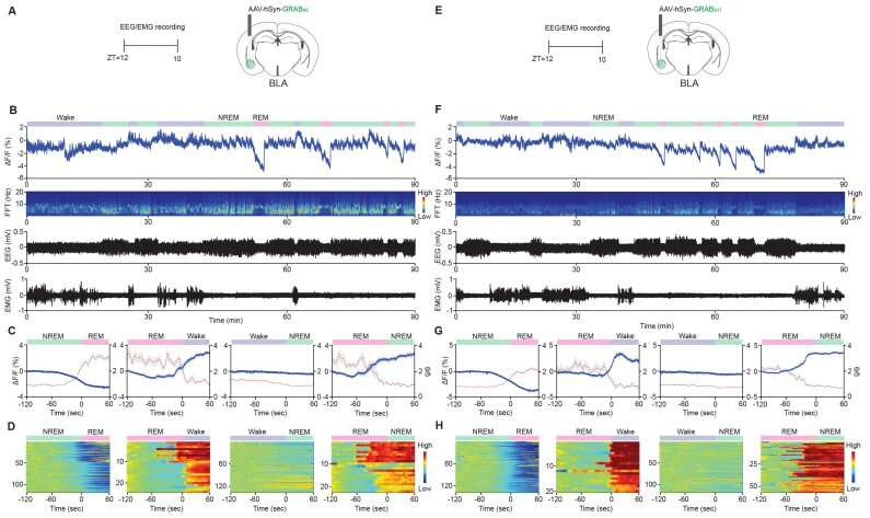 Dopamine found to be an initiator of REM sleep