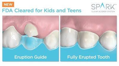 Mixed Dentition Mixed Dentition