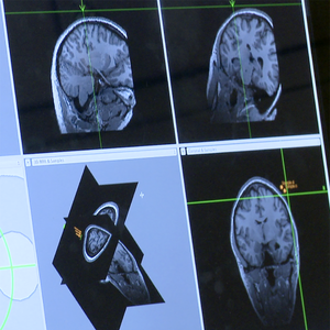 pain brain scan
