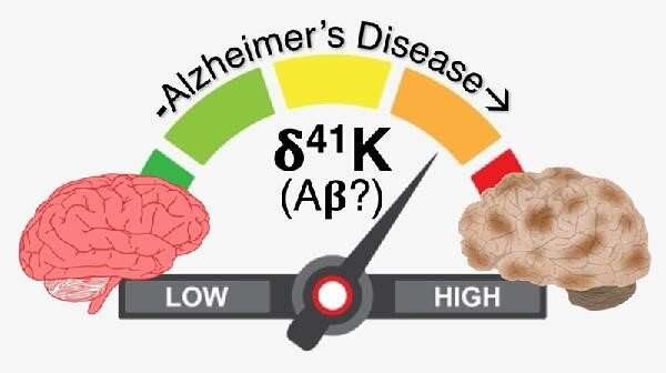 Researchers find accumulation of amyloid beta protein at sites of potassium depletion in the brain