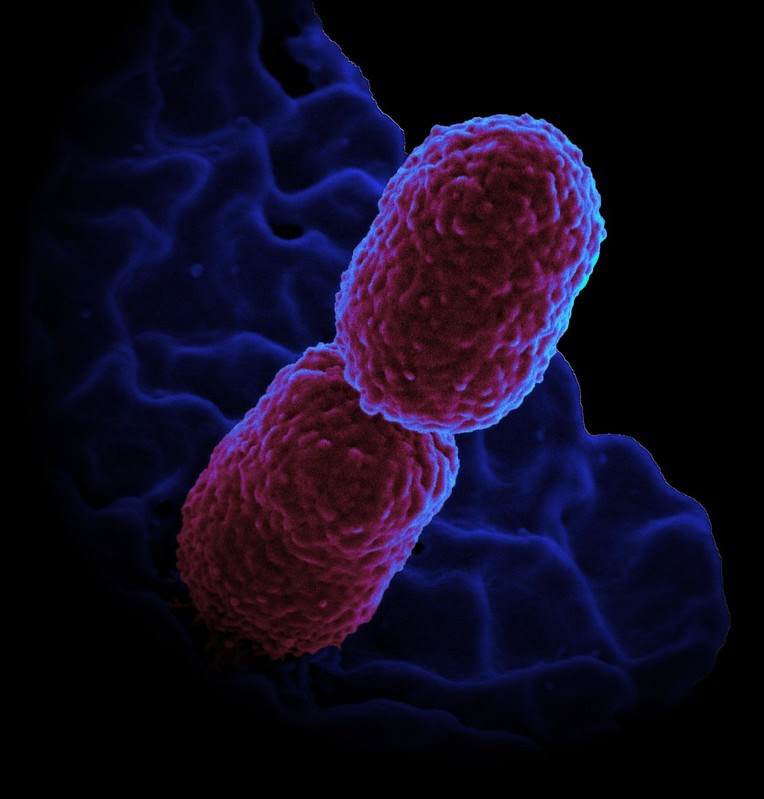 klebsiella bacteria