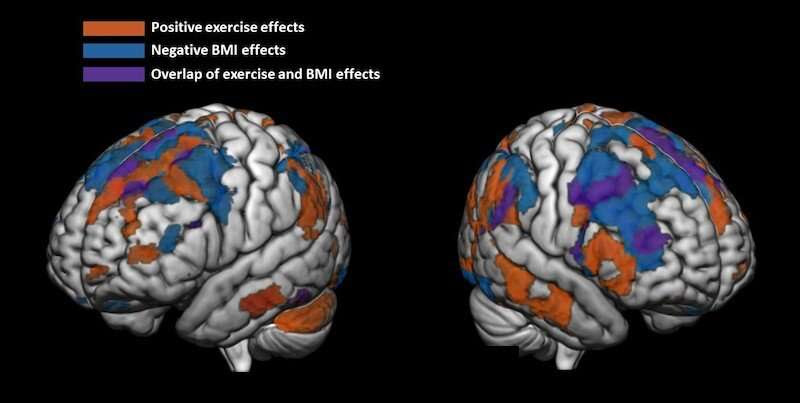 Regular physical activity linked to more 'fit' preteen brains