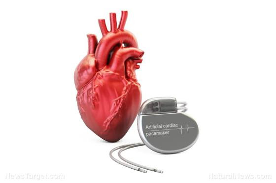UW Medicine DENIES life-saving heart transplant to patient because he won’t take heart-damaging COVID vaccines Pacemaker-heart-3d-rendering-aids-apparatus-arrhythmia