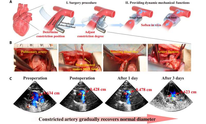 Tailoring collagen-based biomedical materials