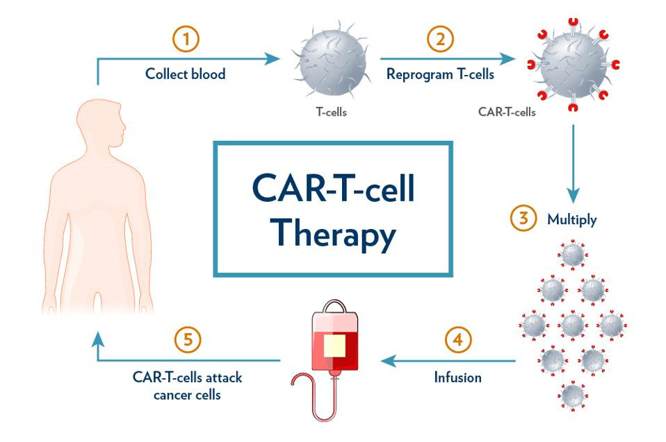 CAR T cell therapy process