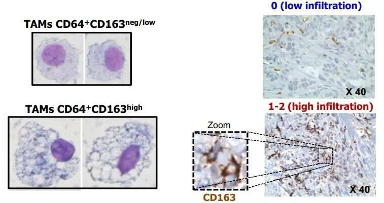 Blood cells could serve as a 'thermometer' to detect breast cancer