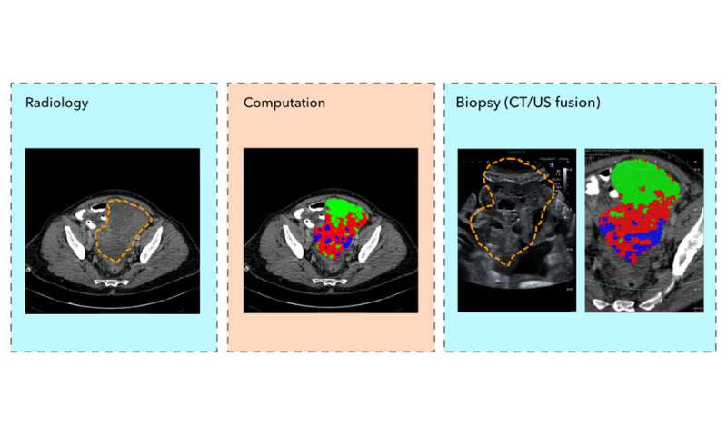 ‘Virtual biopsies’ could replace tissue biopsies in future thanks to technique developed by Cambridge scientists