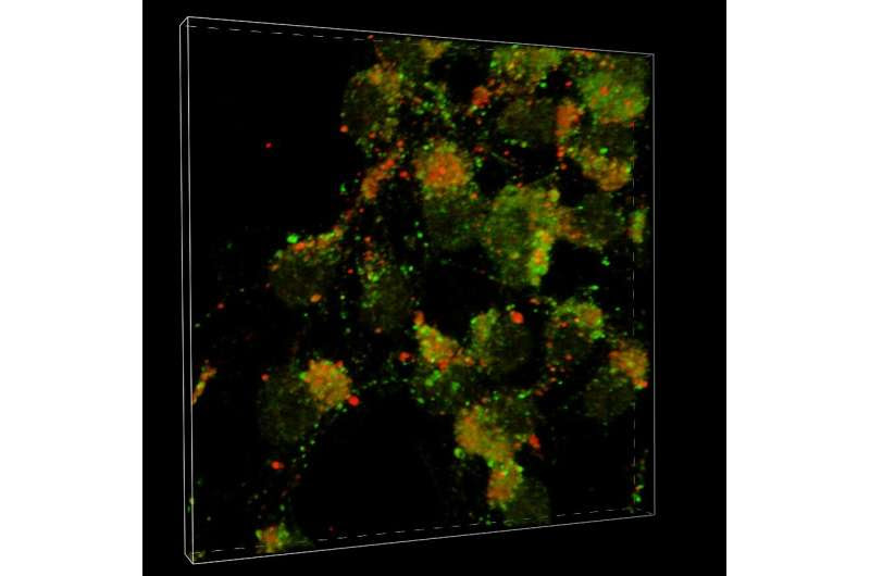 Scripps Research discovery points to possible driver of Parkinson's disease