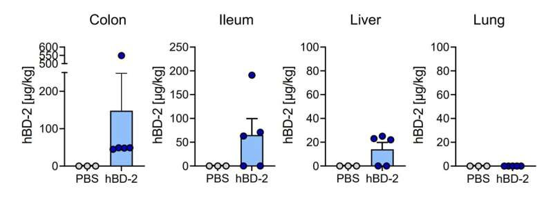 Endogenous molecule protects from life-threatening complications after stem-cell transplantation