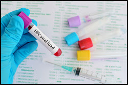 The figure above is a photograph showing a child in Pakistan receiving oral poliovirus vaccine.