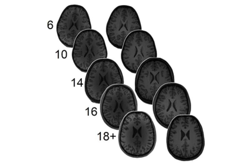 Neurotransmitter levels predict math ability