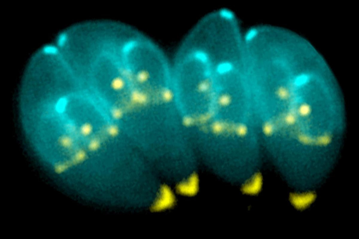 Toxoplasma gondii, the parasite responsible for the disease toxoplasmosis, has been seen to alter behavior and cognition in some infected subjets