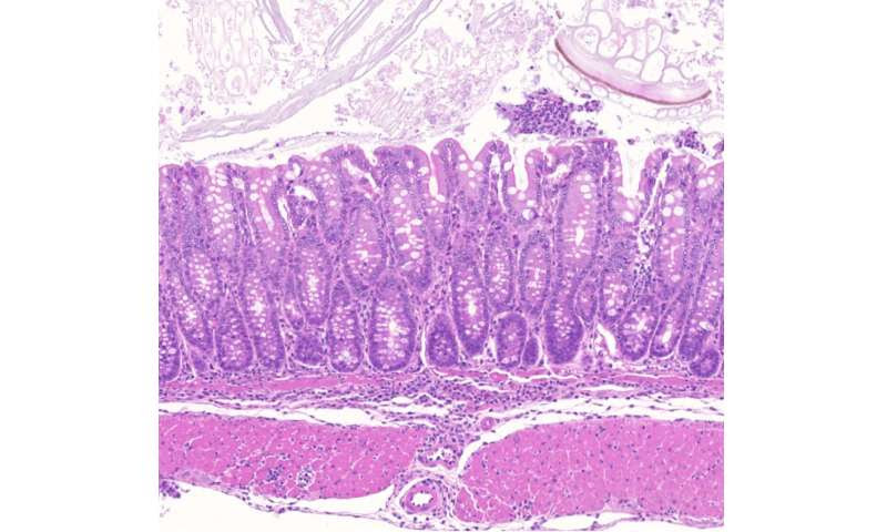 Uncovering how 'dark matter' regions of the genome affect inflammatory diseases