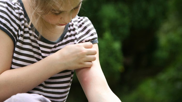 Young child sitting outdoors scratching a mosquito bite on her arm.