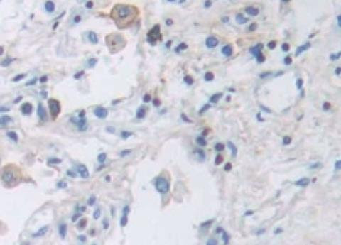 IHC-P analysis of Human Tissue, with DAB staining.