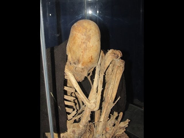 American Doctor Inspects Amazing Ancient Elongated Humanoid Skulls In Bolivia  Sddefault