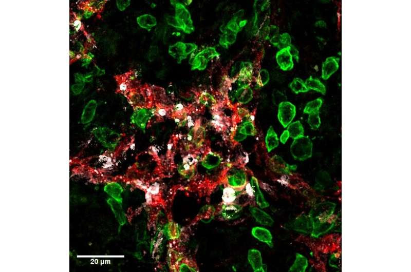 Cancer: the double advantage of killer T-cells