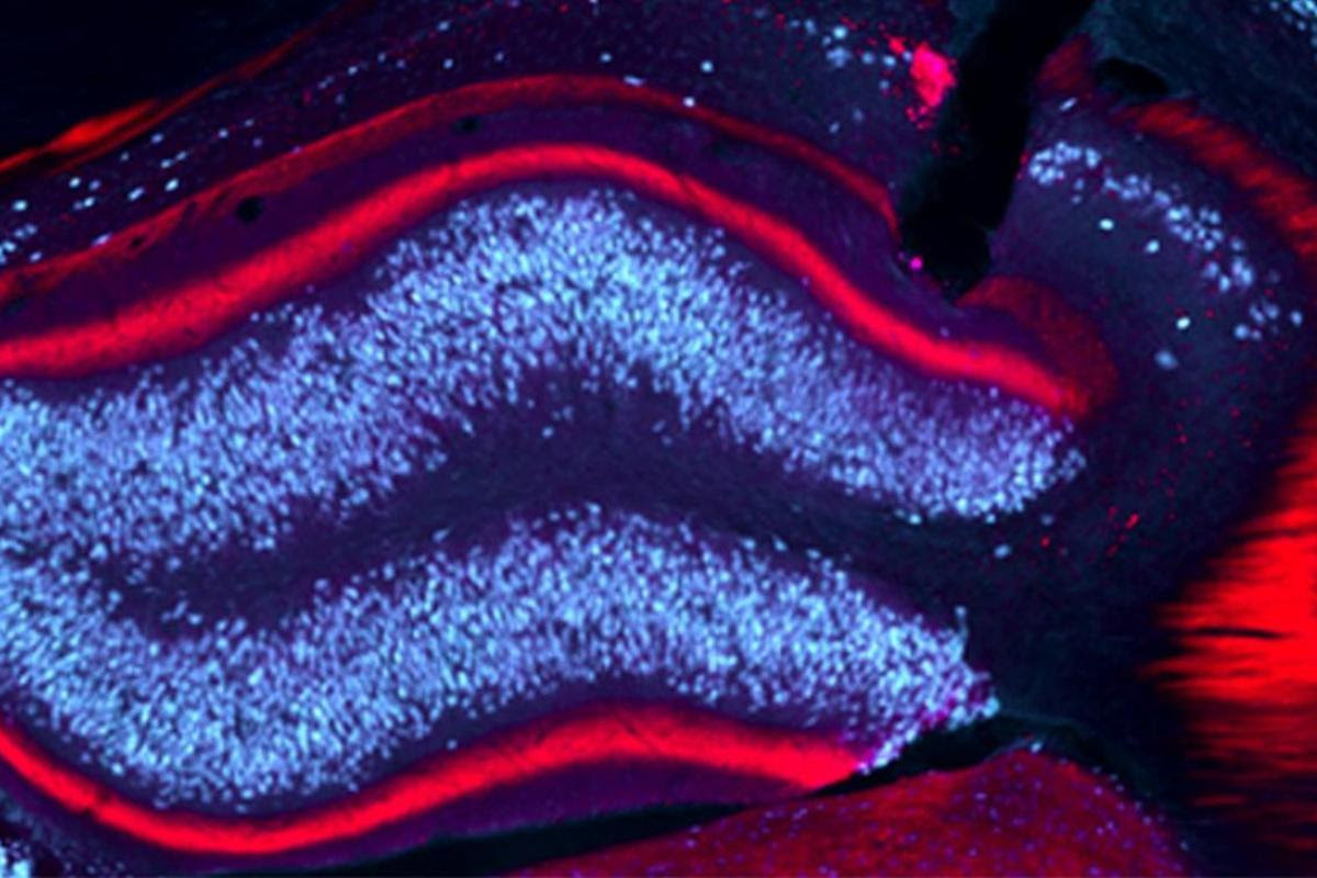 Image of the hippocampus in a mouse model of epilepsy, which researchers successfully targeted with light to prevent epileptic activity and its spread to other brain regions