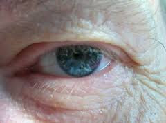 Uso de células

troncales embrionarias para tratar graves enfermedades oculares