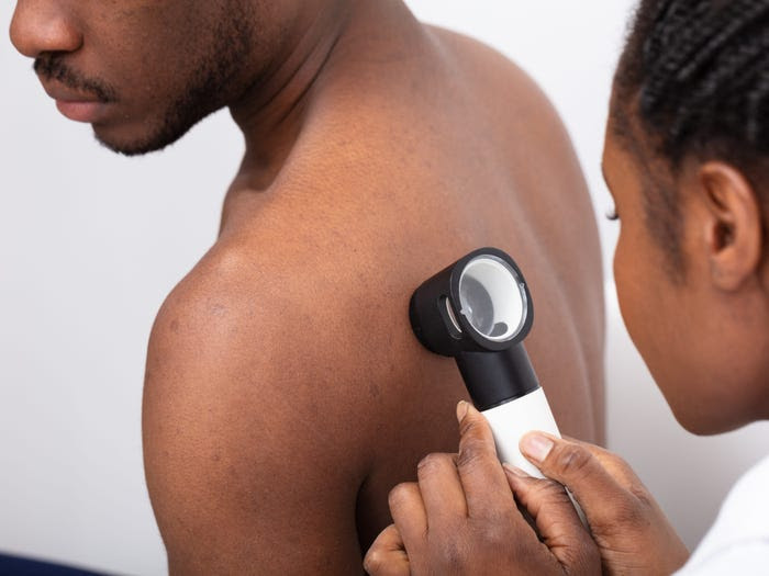 A dermatologist performing a skin cancer screening on a Black man's back