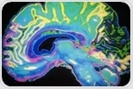 Novel imaging technique produces accurate, real-time intraoperative diagnosis of brain tumors