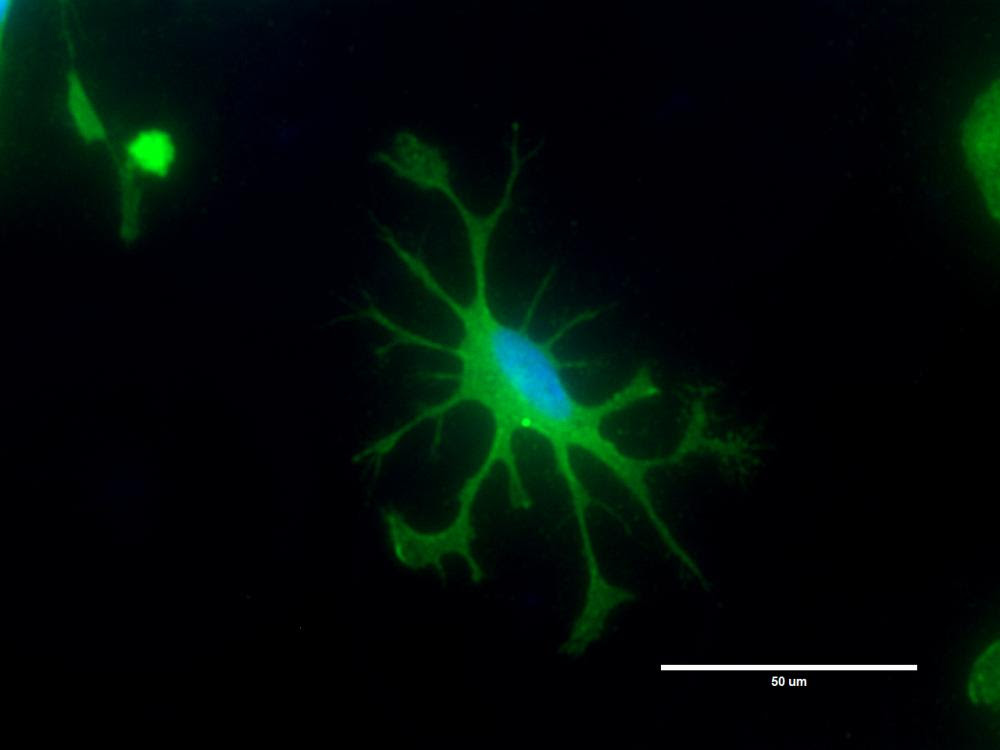 Immunocytochemistry of Axol's Human iPSC-derived Microglia