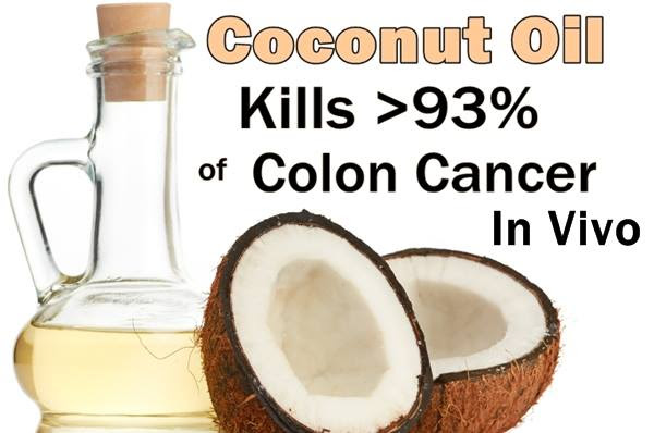  Huge Scientific Discovery: Coconut Oil Kills  93% Colon Cancer Cells In Just Two Days (Videos)  