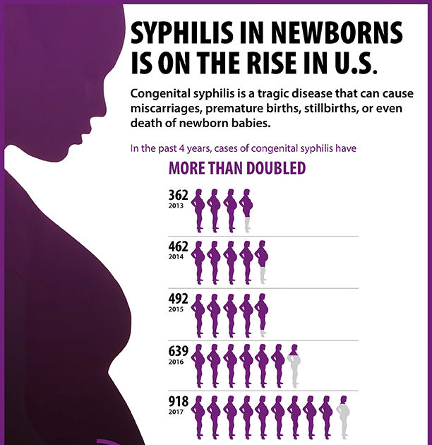 CIENCIASMEDICASNEWS: CDC News: Syphilis In Newborns Reaches 20-year High