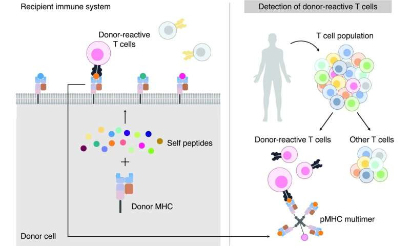 Study pinpoints molecular targets of transplant rejection