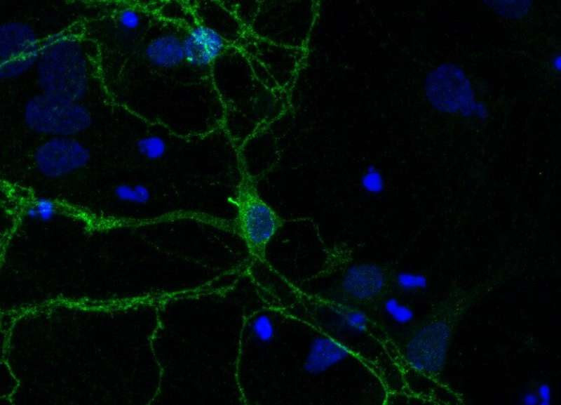 A role for cell 'antennae' in managing dopamine signals in the brain