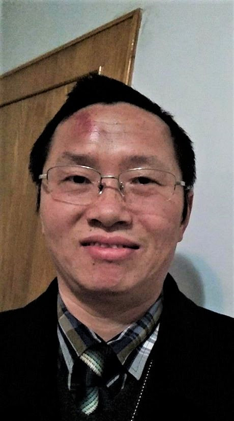  Early Rain Covenant Church member identified as Liu, after being beaten in police custody. (Facebook, Early Rain Covenant Church)