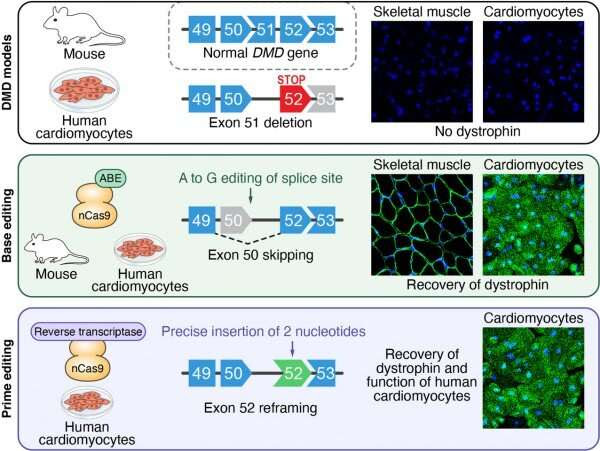 New gene editing strategies developed for duchenne muscular dystrophy