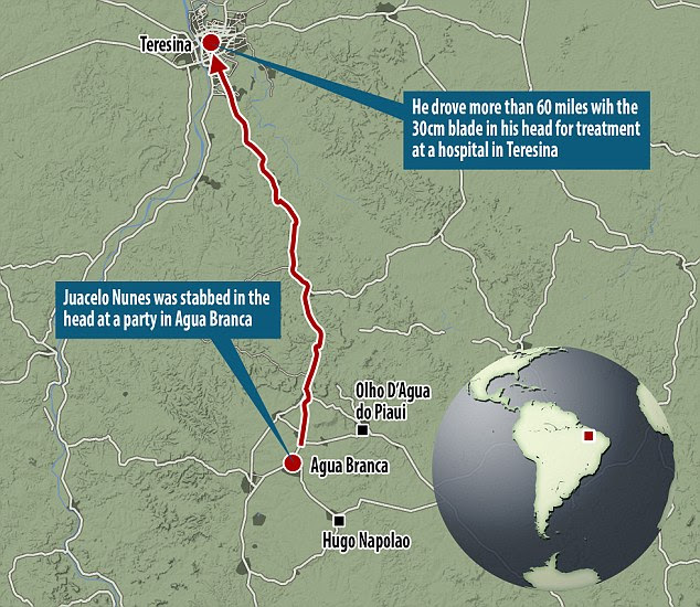 Location: Despite having a knife embedded in his skull, Mr Nunes made the grueling two hour, 60 mile journey along jungle roads from the village of Agua Branca to a hospital in the municipality of Teresina