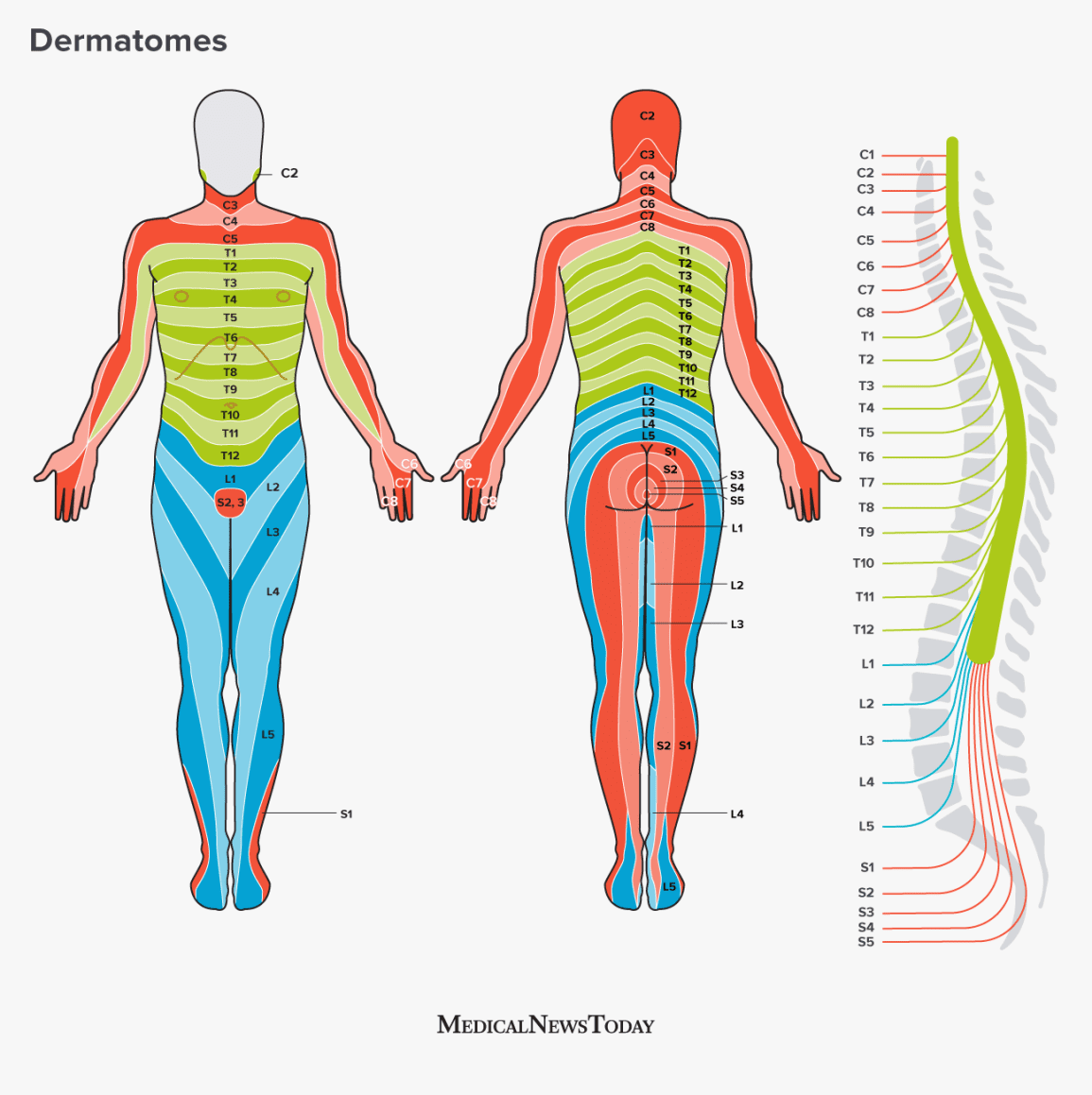 a illustration showing dermatomes