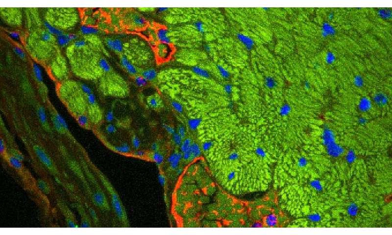 Cleaning up cellular trash helps hearts recover after heart attacks