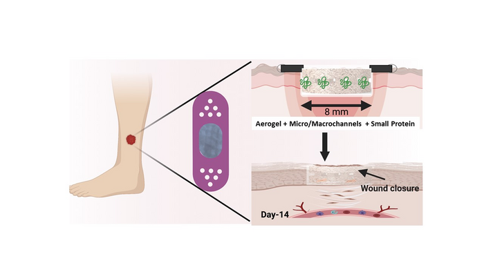 Microchannel-Containing Nanofiber Aerogels with Small Protein Molecule Enable Accelerated Diabetic Wound Healing